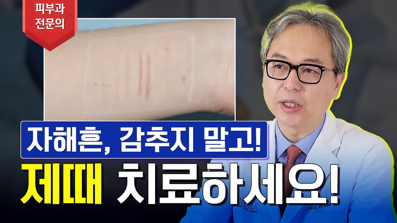 别再遮掩了!治疗自残疤痕时请记住这4点!