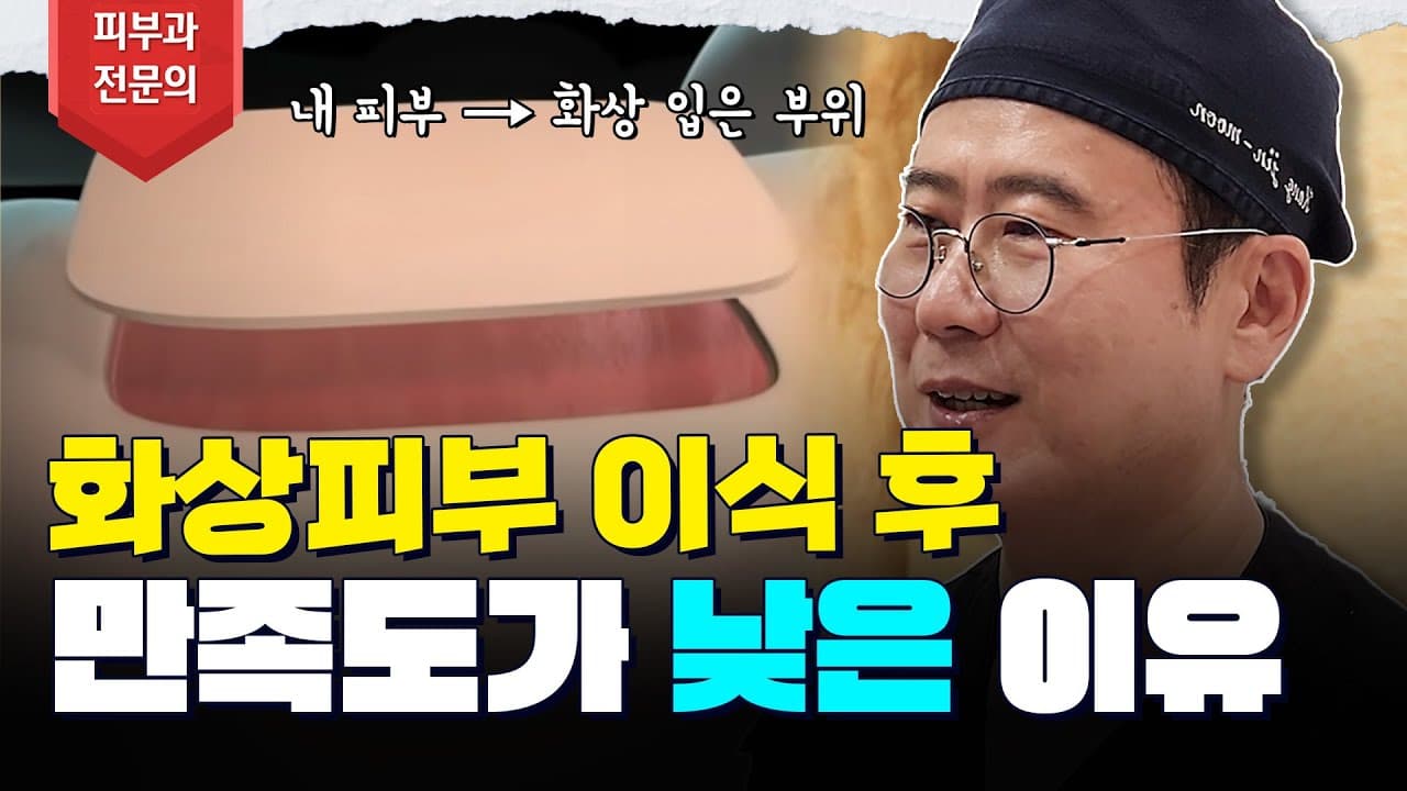 화상 피부이식수술 만족도 낮을 수 밖에 없는 이유😱 피부이식흉터 이질감 없애는 법