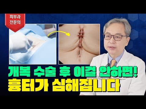 개복 수술 후 흉터 만들고 싶지 않다면 ※ 필수시청 ※ | 암 수술 후 관리 (Feat. 수술흉터 없애는법)