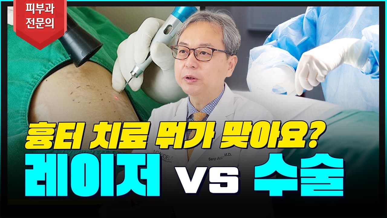 私に合った傷跡治療法は何だろう?