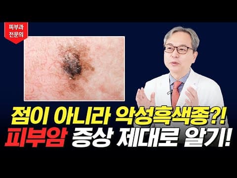 점이 아니라 악성흑색종이었다고..?! 이 영상 보고 피부암 구별해보세요!