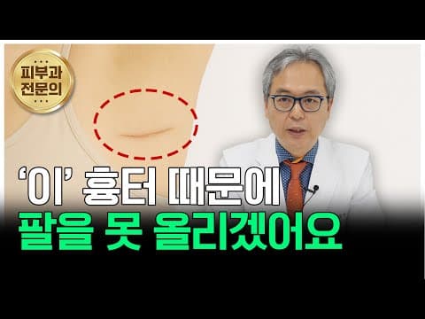 팔을 올릴 수가 없어요… 겨드랑이 절개 흉터, 이대로 괜찮을까요?