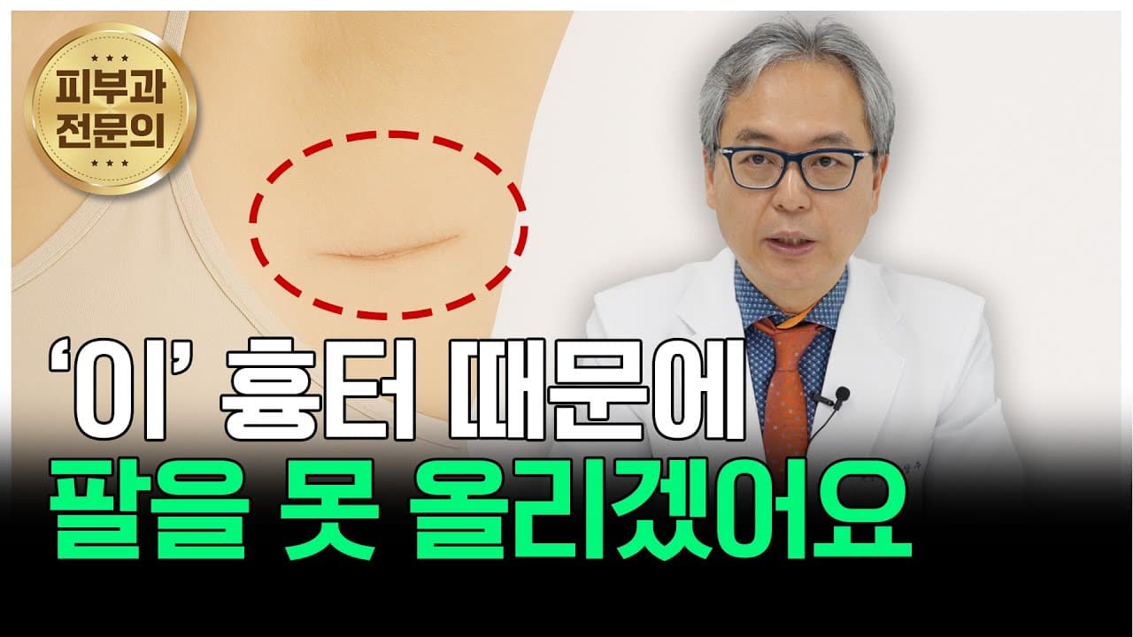 팔을 올릴 수가 없어요… 겨드랑이 절개 흉터, 이대로 괜찮을까요?