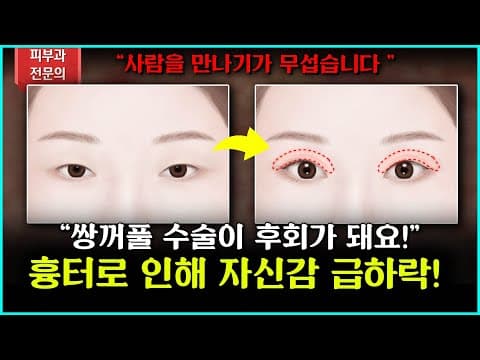 쌍꺼풀수술흉터! 충분히 치료할 수 있습니다. 자신감 회복 GO!