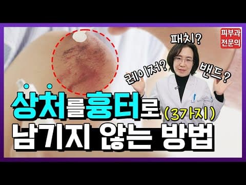 흉터 안 남는 상처 치료 방법!! 이 3가지만 알면 흉터 걱정 안 하셔도 됩니다 🖐️ 습윤 밴드 | 스테로이드 | 패치 | 레이저