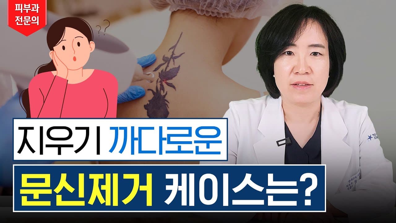 皮膚科専門医も手こずる難しいタトゥー!どうやって消す?
