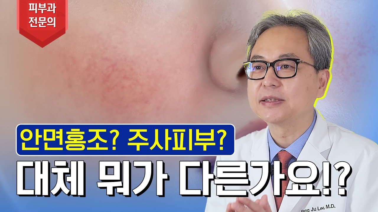 일반 홍조인 줄 알았는데 주사피부라고요? | 주사피부(Rosacea)에 모든 것!