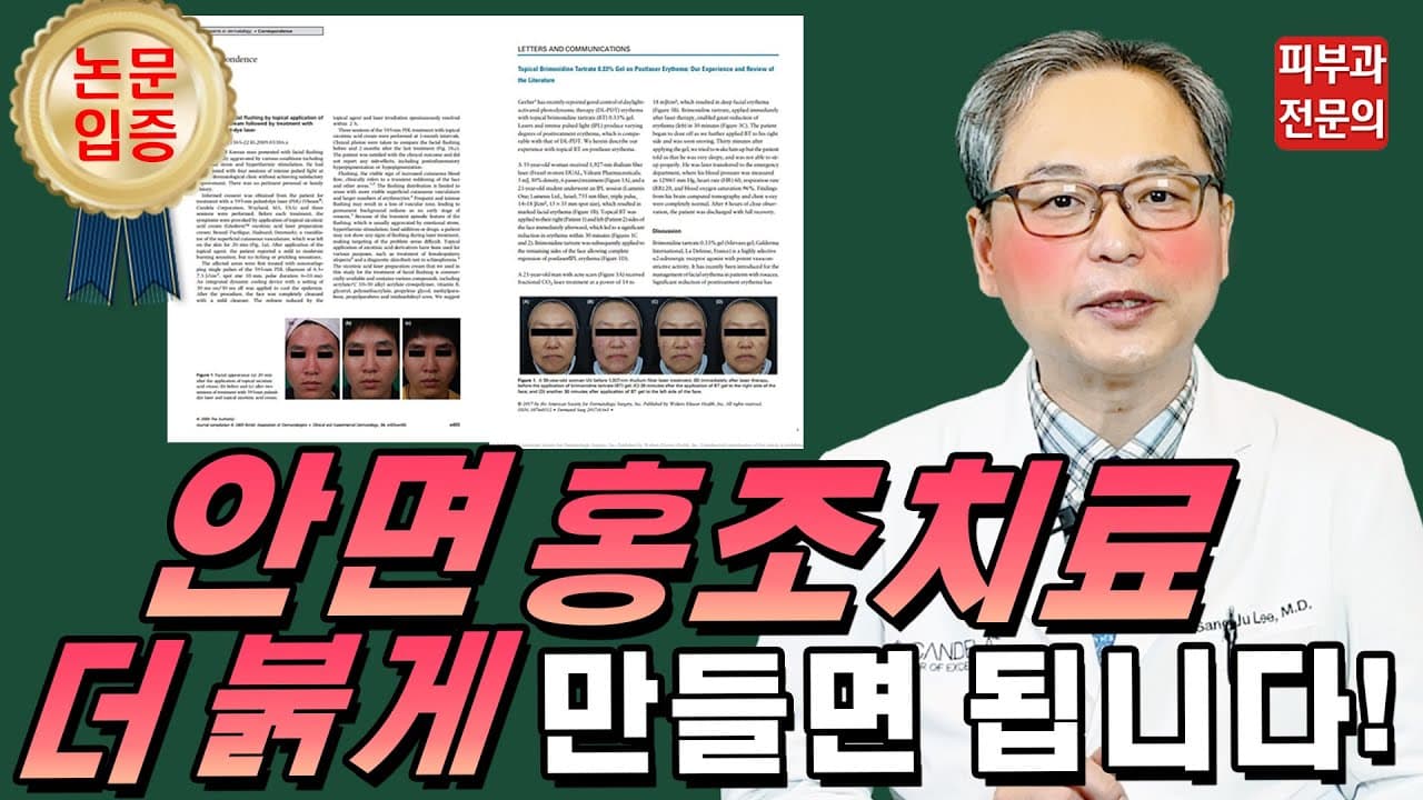 세계적 학회에 소개한 😡 안면홍조 없애는법 😡 공개 (Feat. 홍반유도프리마)