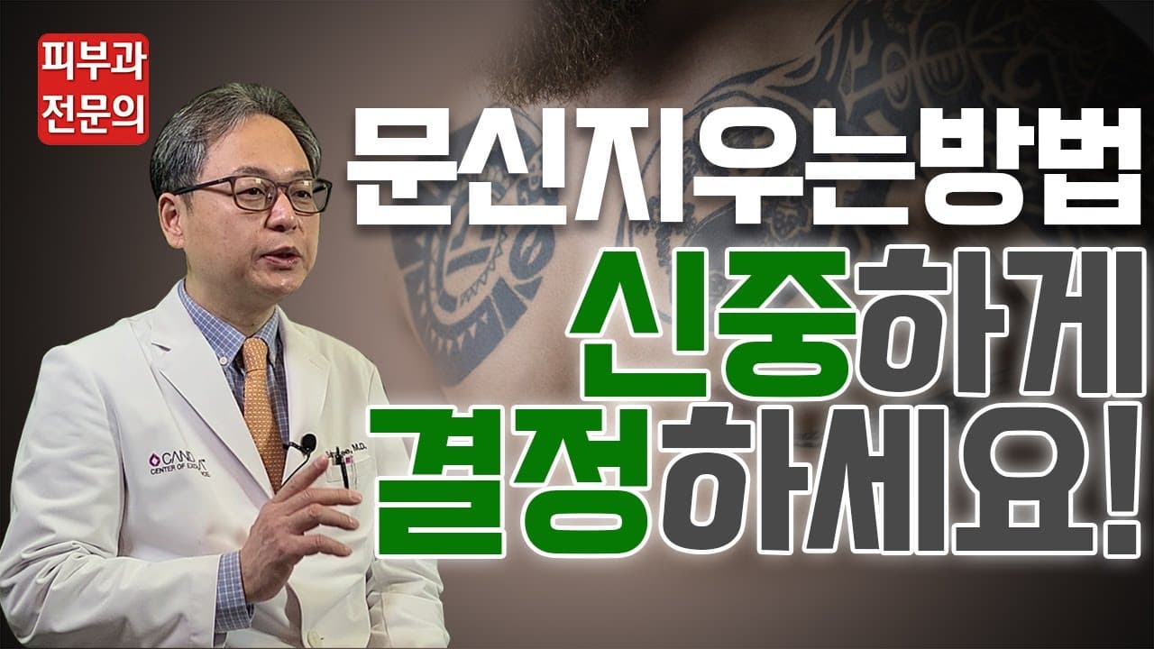 纹身去除方法,请慎重决定 - 抢先一窥纹身去除真实体验!