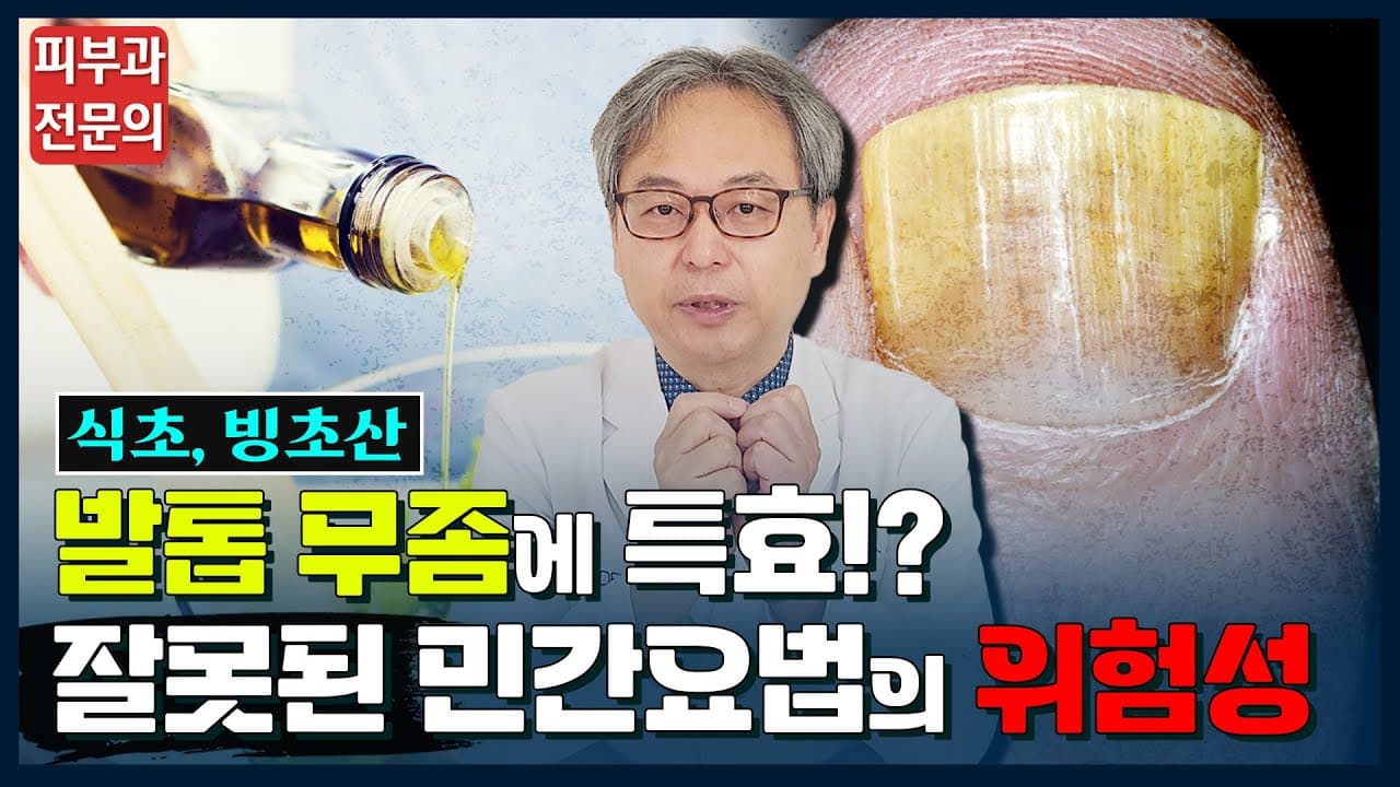 灰指甲的偏方真的有效吗