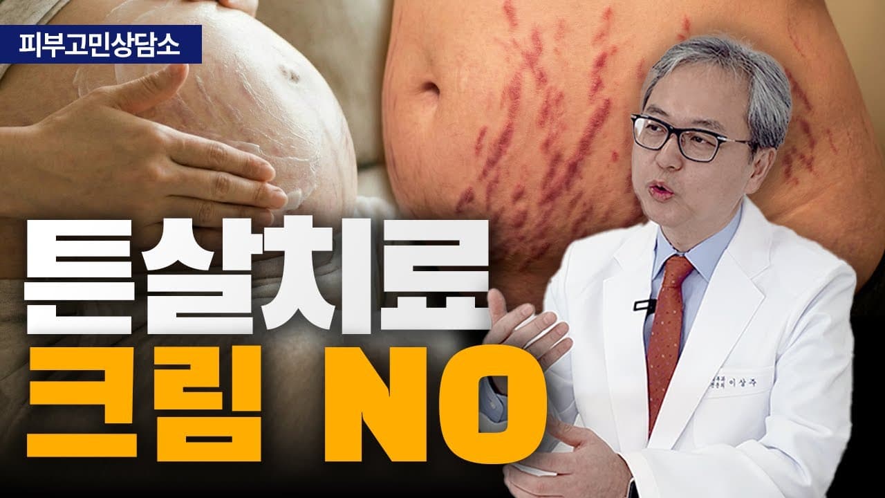 튼살은 늘어난 살이 아니라 찢어진 흉터라고 봅니다 | 신촌 연세스타피부과